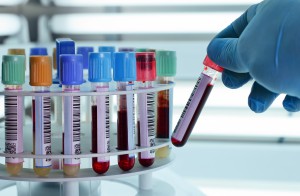 Test tubes in carousel